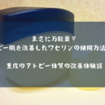 ワセリンでアトピー肌が改善！？一日10回使用して脱ステできました